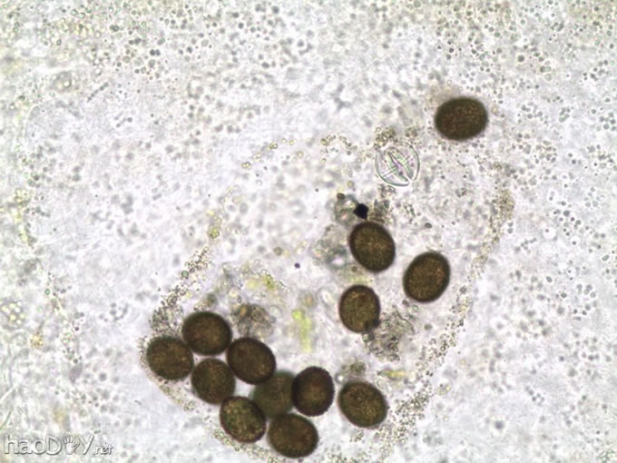原来是吞下的一些藻类.jpg 生物显微镜下的纷繁精彩的小世界