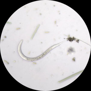 线虫.jpg 生物显微镜下的纷繁精彩的小世界