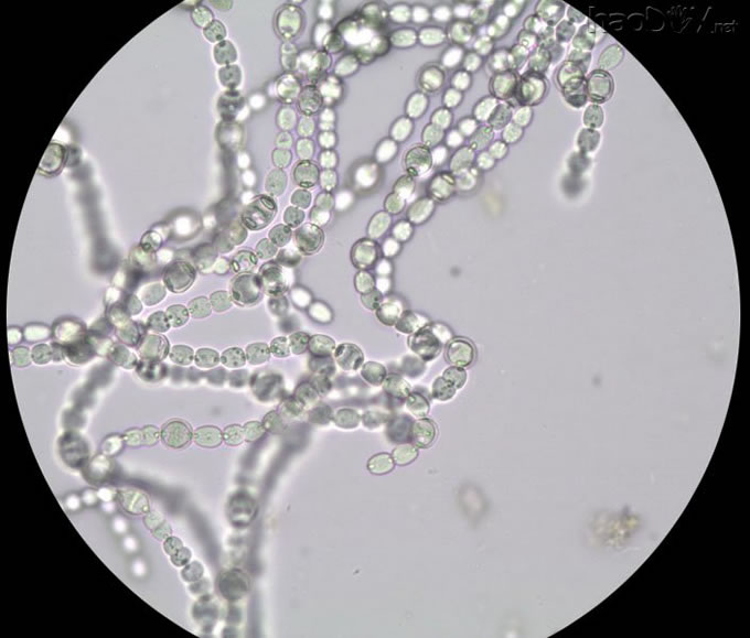 象念珠一样的藻.jpg 生物显微镜下的纷繁精彩的小世界